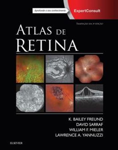 Picture of ATLAS DE RETINA - 2ª ED