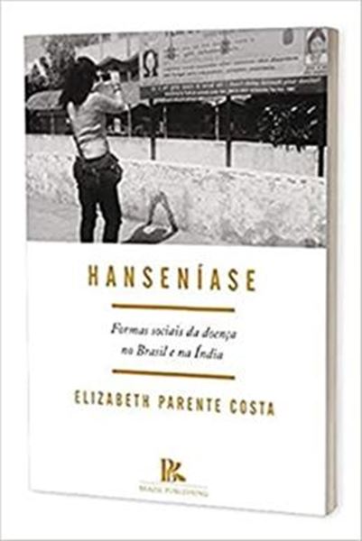 Picture of HANSENIASE FORMAS SOCIAIS DA DOENCA NO BRASIL E NA INDIA