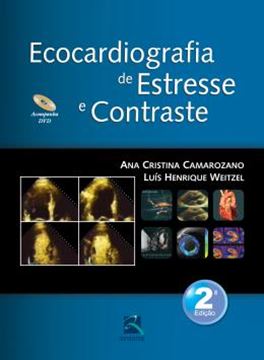 Imagem de ECOCARDIOGRAFIA DE ESTRESSE E CONTRASTE - 2ª ED