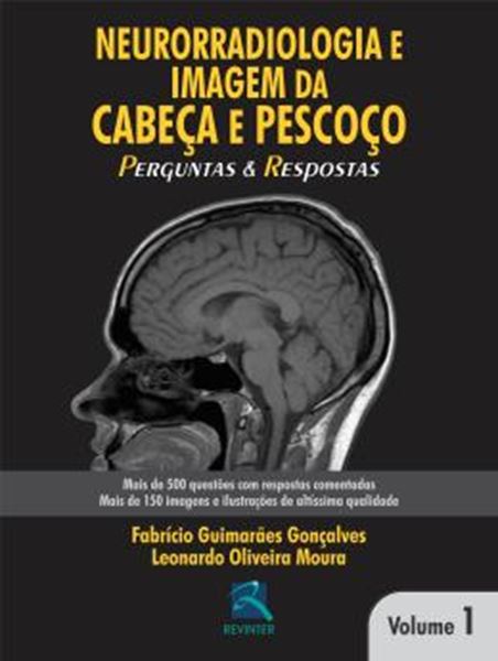 Picture of NEURORRADIOLOGIA EM CABECA E PESCOCO