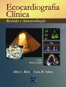 Imagem de ECOCARDIOGRAFIA CLINICA REVISAO E AUTOAVALIACAO