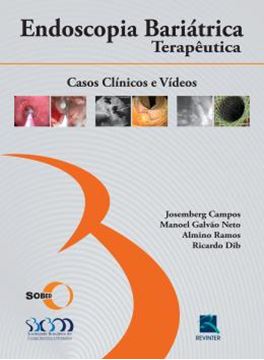 Imagem de ENDOSCOPIA BARIATRICA TERAPEUTICA