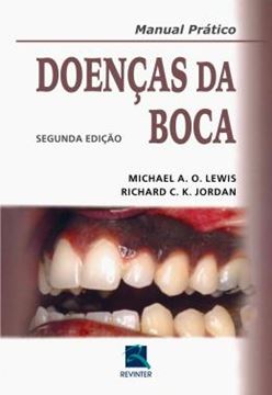 Imagem de DOENCAS DA BOCA - 2ª ED