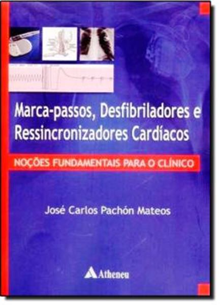 Picture of MARCA-PASSOS, DESFIBRILADORES E  RESSINCRONIZADORES CARDIACOS