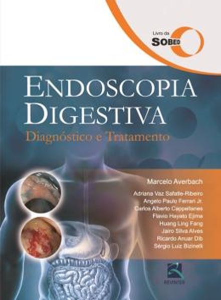 Picture of ENDOSCOPIA DIGESTIVA - DIAGNOSTICO E TRATAMENTO