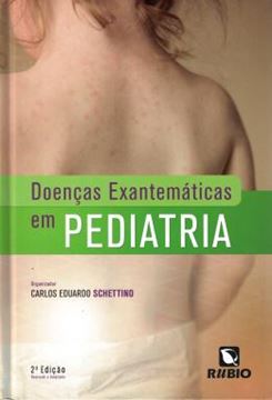 Imagem de DOENCAS EXANTEMATICAS EM PEDIATRIA- 2 º ED