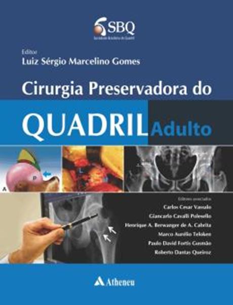 Picture of CIRURGIA PRESERVADORA DO QUADRIL ADULTO