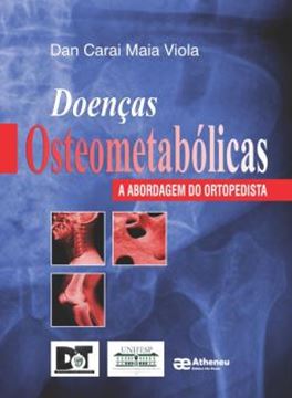 Imagem de DOENCAS OSTEOMETABOLICAS