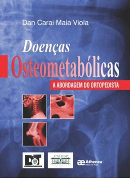 Picture of DOENCAS OSTEOMETABOLICAS
