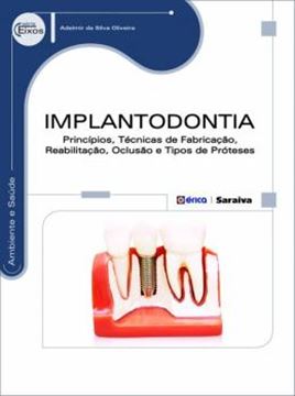 Imagem de IMPLANTODONTIA - PRINCIPIOS, TECNICAS DE FABRICACAO, REABILITACAO, OCLUSAO E TIPOS DE PROTESES