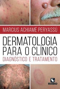 Imagem de DERMATOLOGIA PARA O CLINICO - DIAGNOSTICO E TRATAMENTO