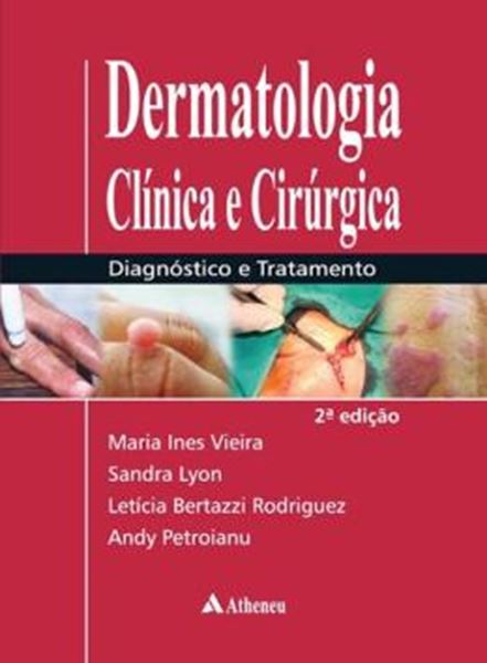 Picture of DERMATOLOGIA CLINICA E CIRURGICA DIAGNOSTICO E TRATAMENTO - 2ª EDICAO