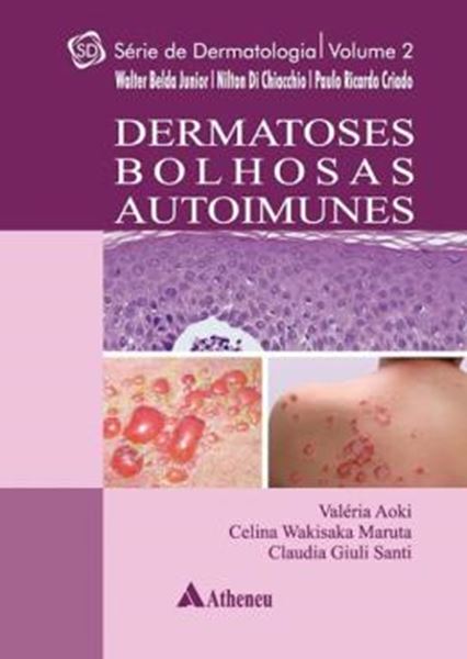 Picture of DERMATOSES BOLHOSAS AUTOIMUNE - SERIE DERMATOLOGIA - VOL. 2
