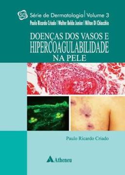 Imagem de DOENCAS DOS VASOS E HIPERCOABILIDADE NA PELE - SERIE DERMATOLOGIA - VOL. 3