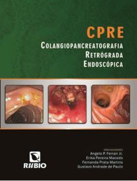 Imagem de CPRE - COLANGIOPANCREATOGRAFIA RETROGRADA ENDOSCOPICA