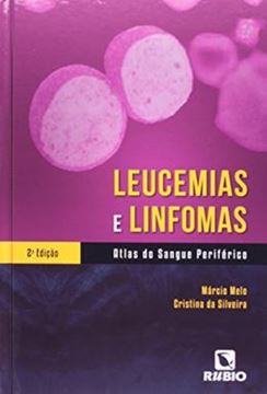 Imagem de LEUCEMIAS E LINFOMAS - 2ª ED