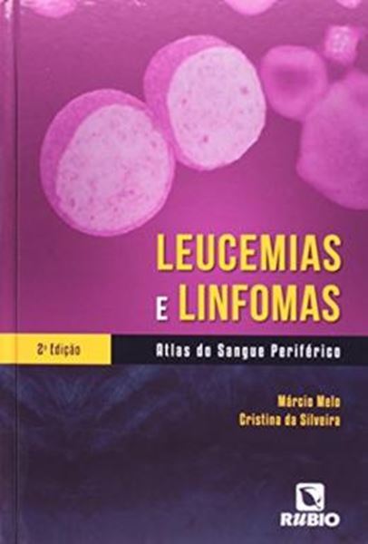 Picture of LEUCEMIAS E LINFOMAS - 2ª ED