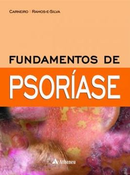 Imagem de FUNDAMENTOS DE PSORIASE