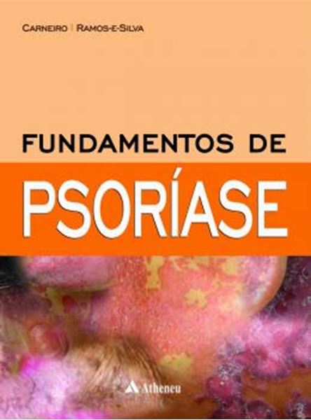 Picture of FUNDAMENTOS DE PSORIASE