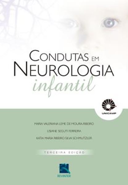 Picture of CONDUTAS EM NEUROLOGIA INFANTIL - 3ª ED