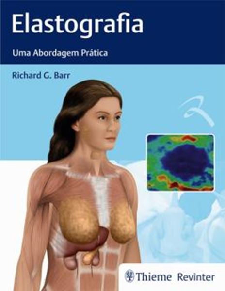 Picture of ELASTOGRAFIA - UMA ABORDAGEM PRATICA