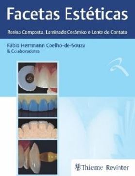 Imagem de FACETAS ESTETICAS - RESINA COMPOSTA, LAMINADO CERAMICO E LENTE DE CONTATO