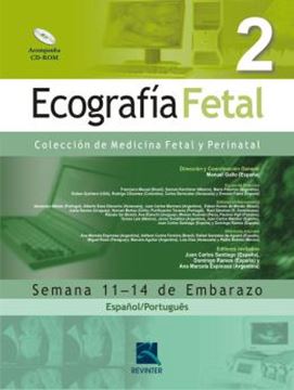 Imagem de ECOGRAFIA FETAL VOL. 2