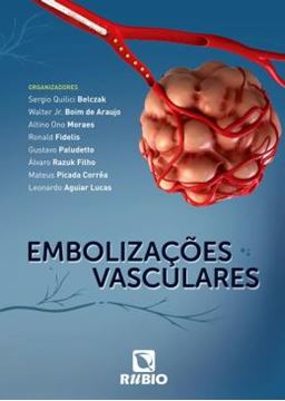Imagem de EMBOLIZACOES VASCULARES