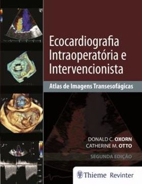 Imagem de ECOCARDIOGRAFIA INTRAOPERATORIA E INTERVENCIONISTA - 2ª ED
