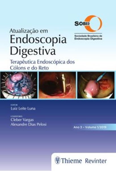 Picture of ATUALIZACAO EM ENDOSCOPIA DIGESTIVA - VOLUME 1 - TERAPEUTICA ENDOSCOPICA DOS COLONS E DO RETO - ANO 3