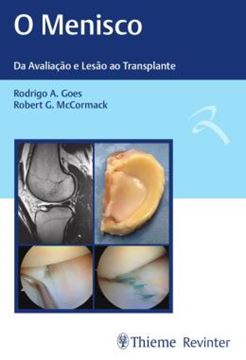 Imagem de MENISCO, O - DA AVALIACAO E LESAO AO TRANSPLANTE
