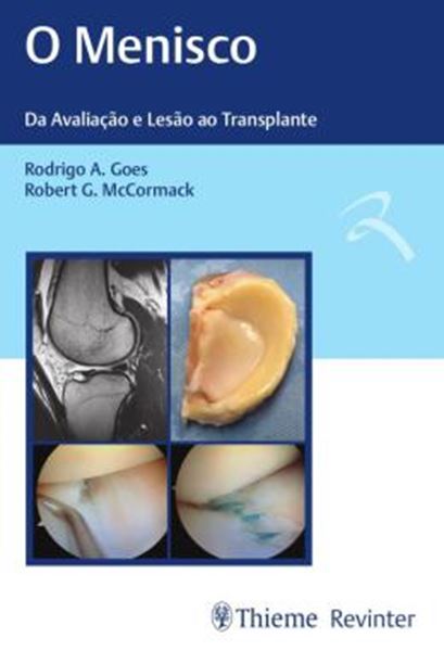 Picture of MENISCO, O - DA AVALIACAO E LESAO AO TRANSPLANTE
