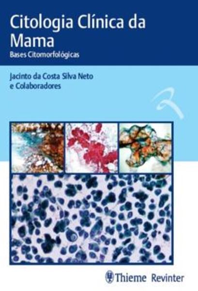 Picture of CITOLOGIA CLINICA DA MAMA - BASES CITOMORFOLOGICAS