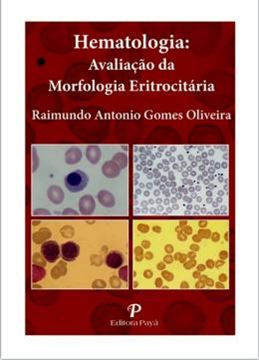Imagem de HEMATOLOGIA - AVALIACAO DA MORFOLOGIA ERITROCITARIA - PRANCHAS