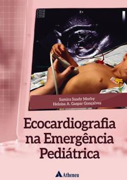 Picture of ECOCARDIOGRAFIA NA EMERGENCIA PEDIATRICA