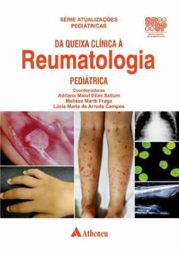 Imagem de DA QUEIXA CLINICA A REUMATOLOGIA PEDIATRICA