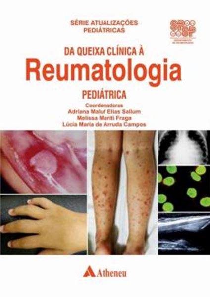 Picture of DA QUEIXA CLINICA A REUMATOLOGIA PEDIATRICA