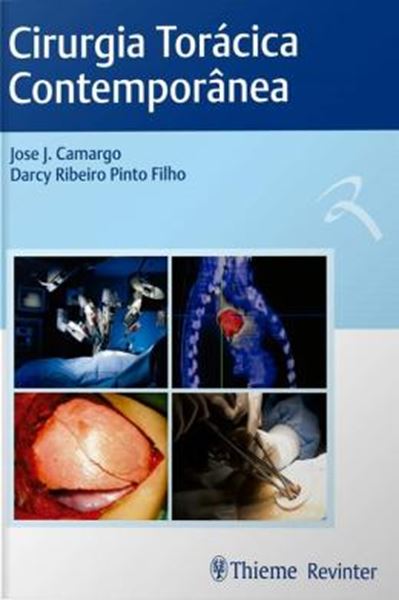 Picture of CIRURGIA TORACICA CONTEMPORANEA 