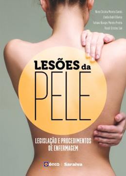 Imagem de LESOES DA PELE