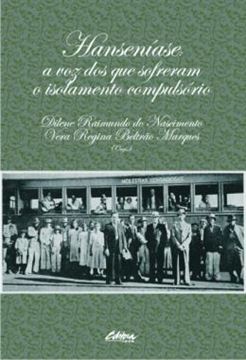 Imagem de HANSENIASE - A VOZ DOS QUE SOFRERAM O ISOLAMENTO COMPULSORIO