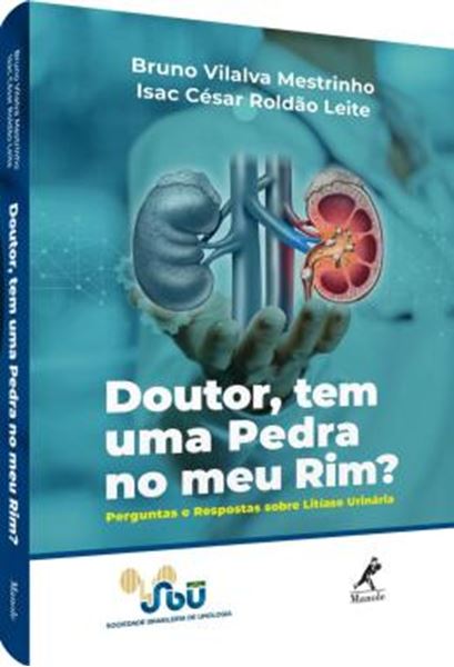 Picture of DOUTOR, TEM UMA PEDRA NO MEU RIM? - PERGUNTAS E RESPOSTAS SOBRE LITIASE URINARIA
