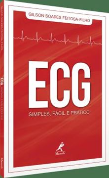 Imagem de ECG SIMPLES, FACIL E PRATICO