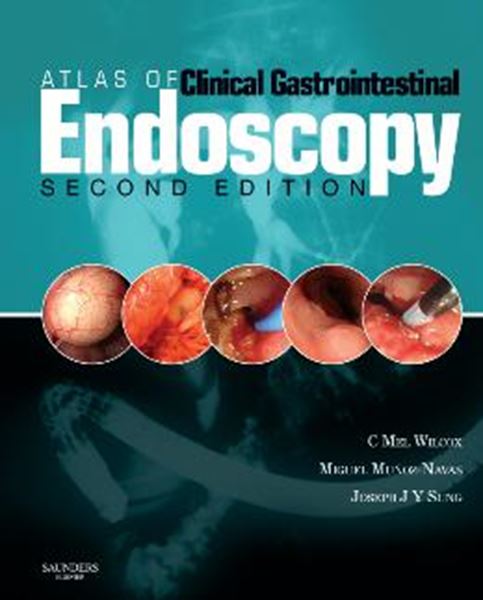 Picture of ATLAS/GASTROINTESTINAL ENDOSCOPY WITH CD-ROM - 2ND ED