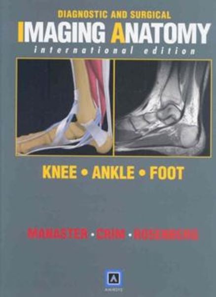 Picture of DIAGNOSTIC AND SURGICAL IMAGING ANATOMY: KNEE, ANKLE, FOOT (INTERNATIONAL EDITION)