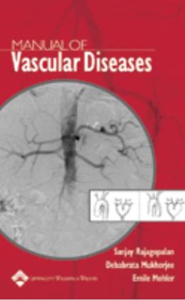 Picture of MANUAL OF VASCULAR DISEASES