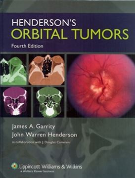 Imagem de HENDERSON´S ORBITAL TUMORS - 4TH ED