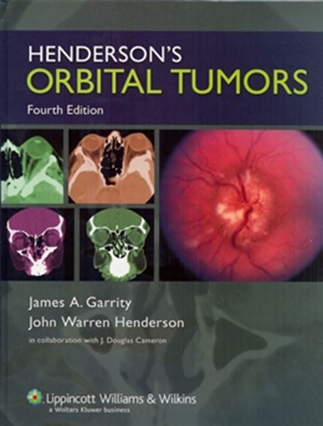 Picture of HENDERSON´S ORBITAL TUMORS - 4TH ED