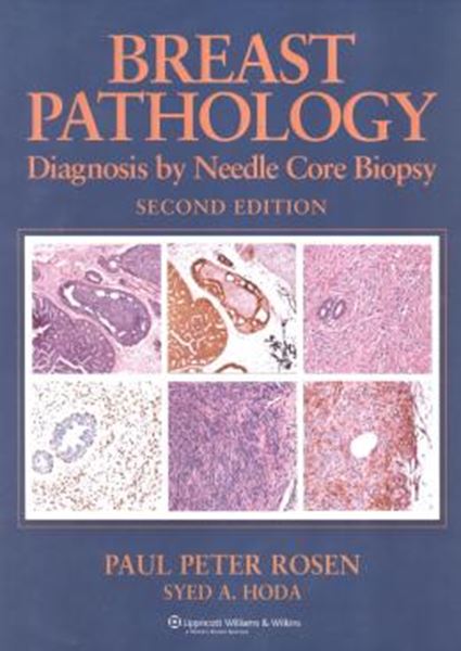 Picture of BREAST PATHOLOGY - DIAGNOSIS BY NEEDLE CORE BIOPSY
