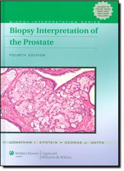 Picture of BIOPSY INTERPRETATION OF THE PROSTATE