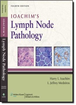 Imagem de IOACHIM´S LYMPH NODE PATHOLOGY